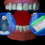 Relazione tra Denti Malati e Artrite