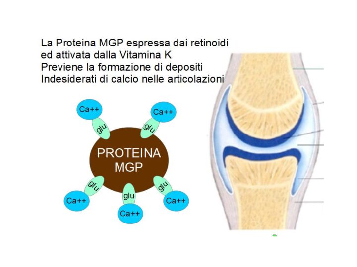 Vitamina K contro le artrosi attraverso l'attivazione di MGP