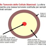 La Teoria Staminale delle cellule Tumorali