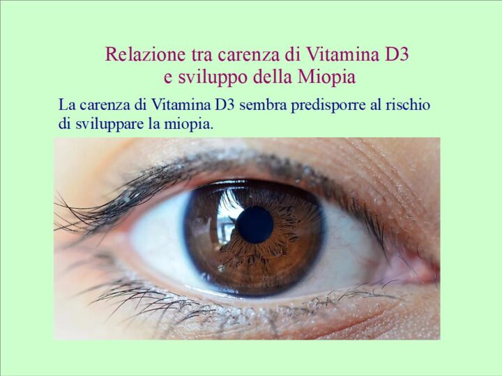Relazione tra Vitamina D3 e miopia