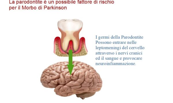 I batteri della parodontite sono un fattore di rischio per il morbo di Parkinson